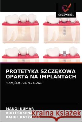 Protetyka SzczĘkowa Oparta Na Implantach Manoj Kumar, Aditi Saxena, Rahul Katyayan 9786203402544 Wydawnictwo Nasza Wiedza - książka