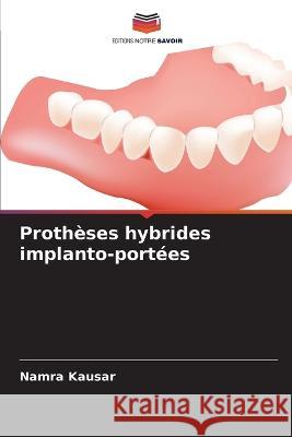 Protheses hybrides implanto-portees Namra Kausar   9786206243106 Editions Notre Savoir - książka