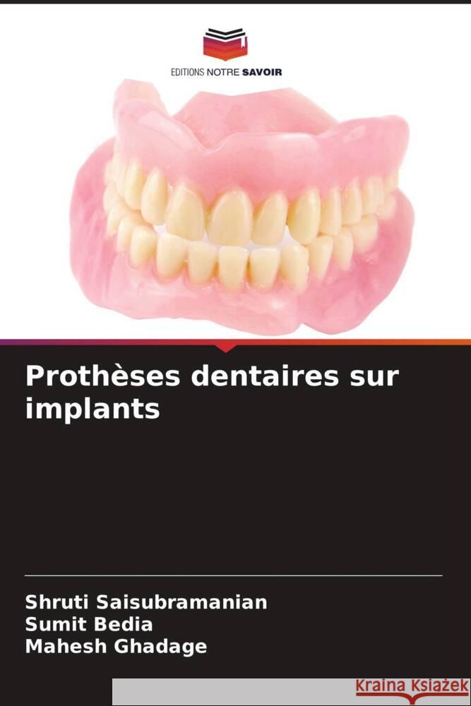 Prothèses dentaires sur implants Saisubramanian, Shruti, Bedia, Sumit, Ghadage, Mahesh 9786204648200 Editions Notre Savoir - książka