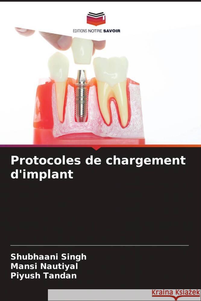 Protocoles de chargement d'implant Singh, Shubhaani, Nautiyal, Mansi, Tandan, Piyush 9786204857541 Editions Notre Savoir - książka