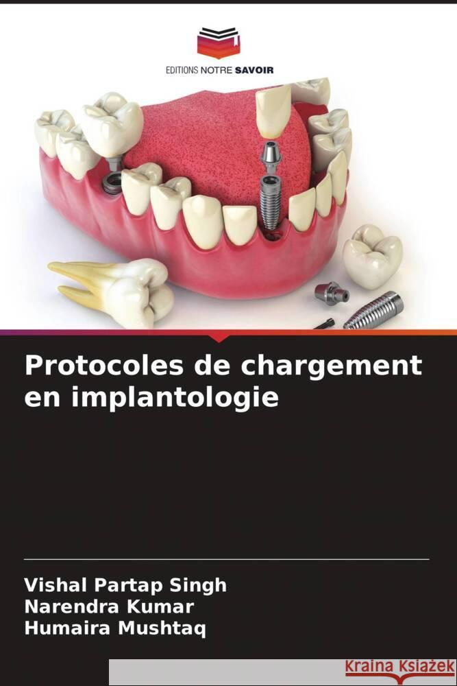 Protocoles de chargement en implantologie Singh, Vishal Partap, Kumar, Narendra, Mushtaq, Humaira 9786205109458 Editions Notre Savoir - książka