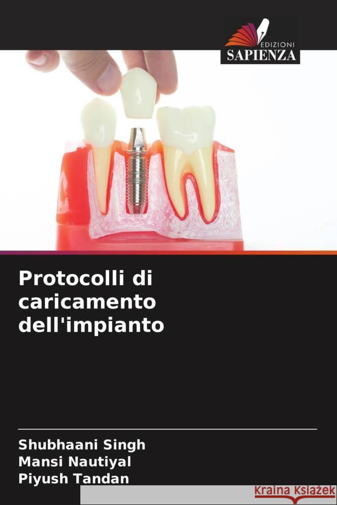 Protocolli di caricamento dell'impianto Singh, Shubhaani, Nautiyal, Mansi, Tandan, Piyush 9786204857558 Edizioni Sapienza - książka