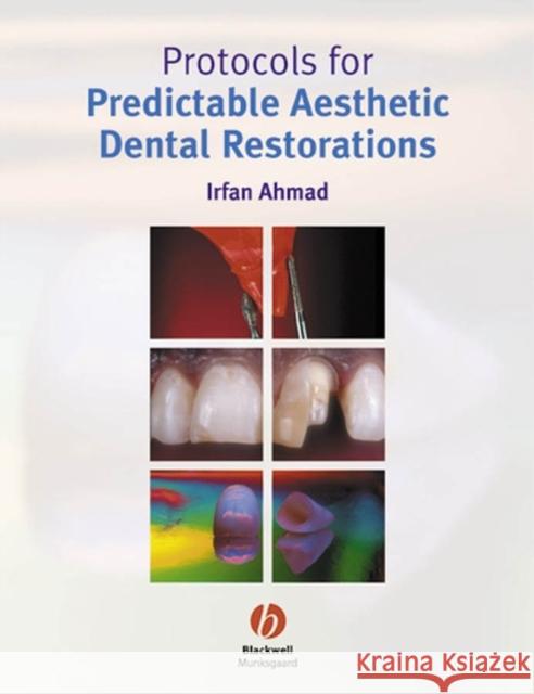 Protocols for Predictable Aesthetic Dental Restorations Irfan Ahmad 9781405118200 Blackwell Publishers - książka