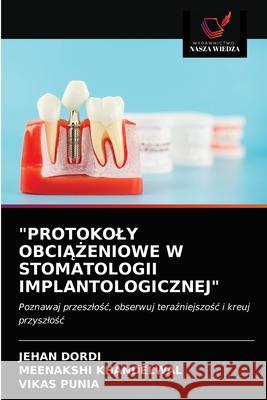 Protokoly ObciĄŻeniowe W Stomatologii Implantologicznej Dordi, Jehan 9786203604160 Wydawnictwo Nasza Wiedza - książka