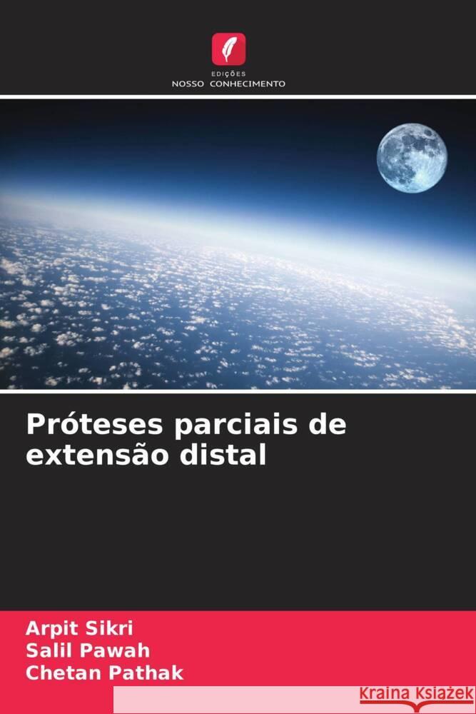 Pr?teses parciais de extens?o distal Arpit Sikri Salil Pawah Chetan Pathak 9786207427307 Edicoes Nosso Conhecimento - książka