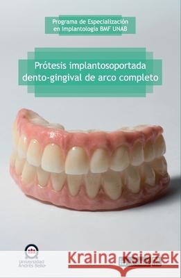 Pr?tesis implantosoportada dento-gingival de arco completo Programa d 9789560115720 Ril - książka