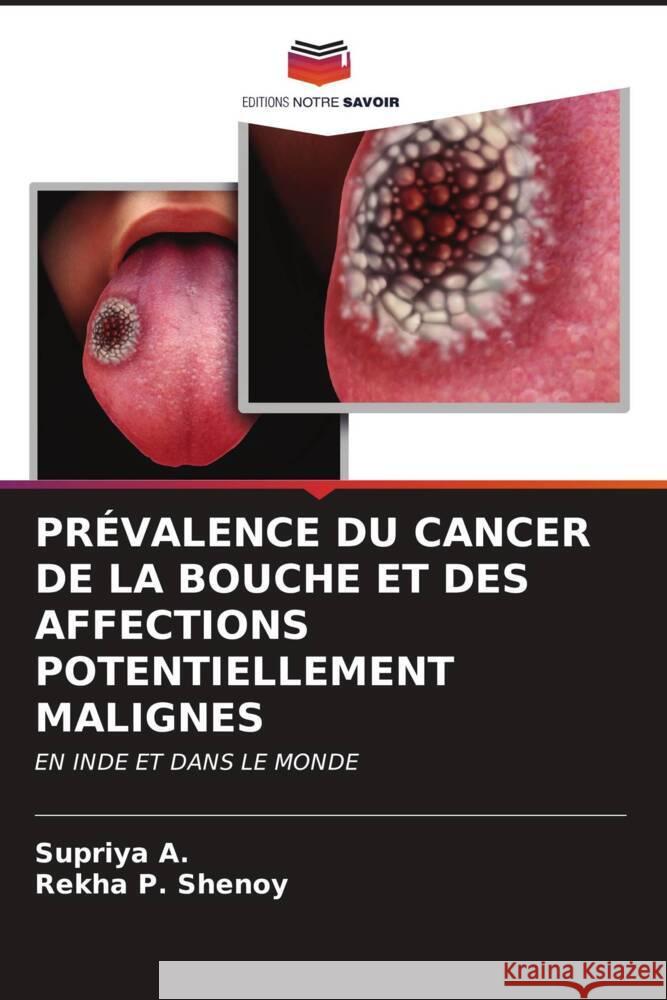 Pr?valence Du Cancer de la Bouche Et Des Affections Potentiellement Malignes Supriya A Rekha P. Shenoy 9786206615330 Editions Notre Savoir - książka