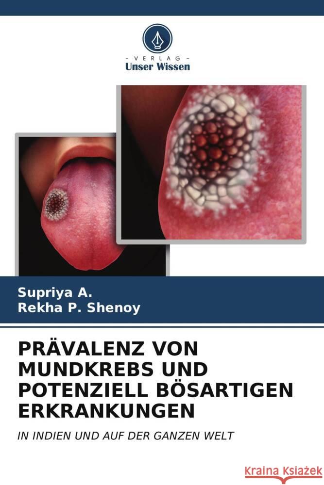 Pr?valenz Von Mundkrebs Und Potenziell B?sartigen Erkrankungen Supriya A Rekha P. Shenoy 9786206615316 Verlag Unser Wissen - książka