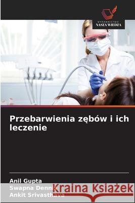 Przebarwienia zebów i ich leczenie Gupta, Anil, Dennis, Swapna, Srivasthava, Ankit 9786206764915 Wydawnictwo Nasza Wiedza - książka