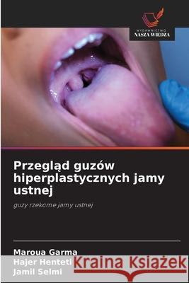 Przeglad guzów hiperplastycznych jamy ustnej Garma, Maroua, Henteti, Hajer, Selmi, Jamil 9786208873097 Wydawnictwo Nasza Wiedza - książka