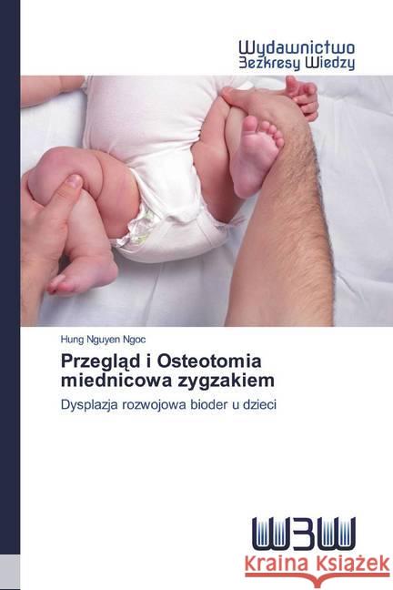 Przeglad i Osteotomia miednicowa zygzakiem : Dysplazja rozwojowa bioder u dzieci Nguyen Ngoc, Hung 9786200812452 Wydawnictwo Bezkresy Wiedzy - książka