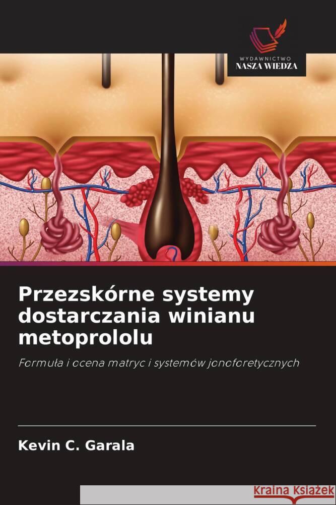 Przezskórne systemy dostarczania winianu metoprololu Garala, Kevin C. 9786208309244 Wydawnictwo Nasza Wiedza - książka