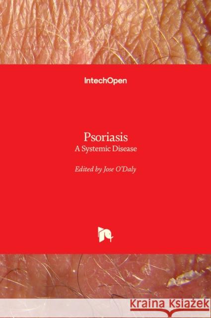 Psoriasis: A Systemic Disease Jose O 9789535102816 Intechopen - książka