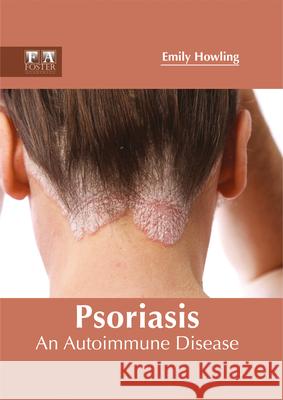 Psoriasis: An Autoimmune Disease Emily Howling 9781632424754 Foster Academics - książka