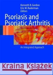 Psoriasis and Psoriatic Arthritis: An Integrated Approach Kenneth B. Gordon Eric M. Ruderman 9783540212805 Springer - książka