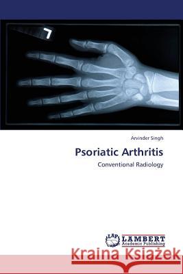 Psoriatic Arthritis Singh Arvinder 9783659431364 LAP Lambert Academic Publishing - książka