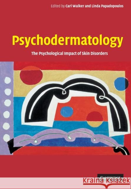 Psychodermatology: The Psychological Impact of Skin Disorders Walker, Carl 9780521542296 Cambridge University Press - książka