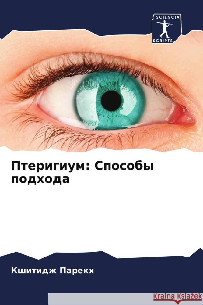 Pterigium: Sposoby podhoda Parekh, Kshitidzh 9786206428046 Sciencia Scripts - książka