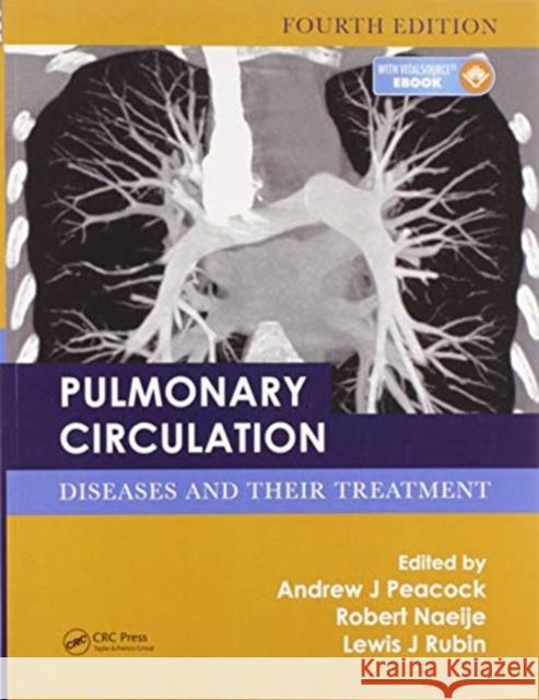 Pulmonary Circulation: Diseases and Their Treatment, Fourth Edition Andrew J. Peacock Robert Naeije Lewis J. Rubin 9780367574918 CRC Press - książka