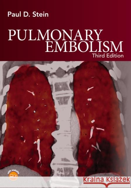 Pulmonary Embolism Paul D. Stein 9781119039082 Wiley-Blackwell - książka