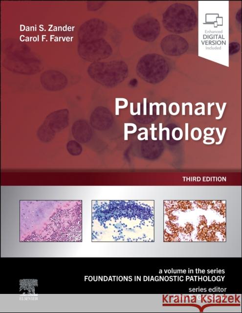 Pulmonary Pathology Dani S. Zander Carol F. Farver John R. Goldblum 9780323935487 Elsevier - książka