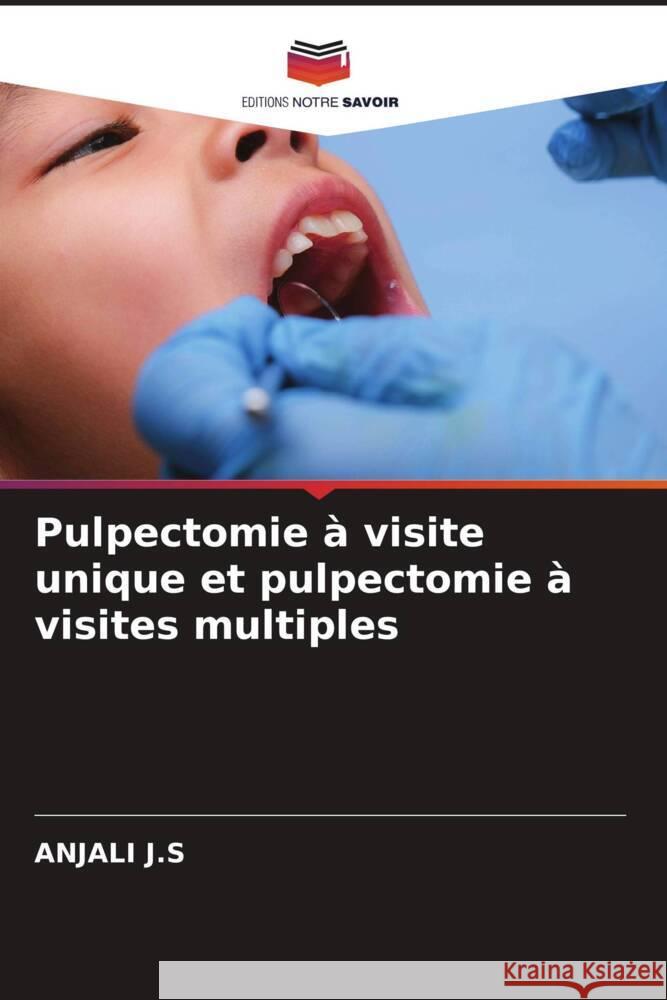Pulpectomie à visite unique et pulpectomie à visites multiples J.S, ANJALI 9786209082825 Editions Notre Savoir - książka