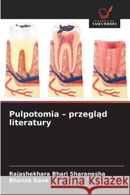 Pulpotomia - przegląd literatury Bhari Sharanesha, Rajashekhara, Dave, Bhavna 9786209804144 Wydawnictwo Nasza Wiedza - książka