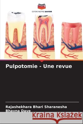 Pulpotomie - Une revue Bhari Sharanesha, Rajashekhara, Dave, Bhavna 9786209898853 Editions Notre Savoir - książka