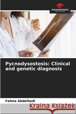Pycnodysostosis: Clinical and genetic diagnosis Abdelhedi, Fatma 9786208660338 Our Knowledge Publishing - książka