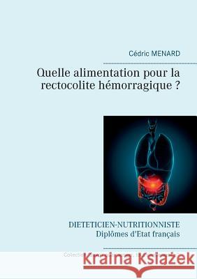 Quelle alimentation pour la rectocolite hémorragique ? Cedric Menard 9782322080717 Books on Demand - książka