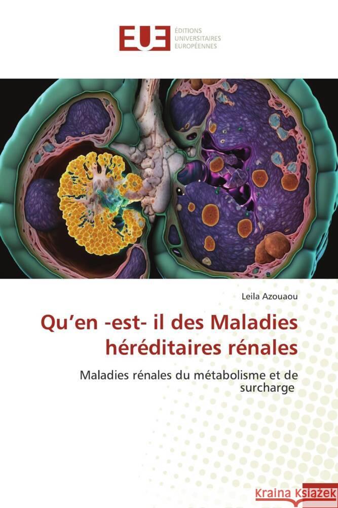 Qu'en -est- il des Maladies héréditaires rénales Azouaou, Leila 9786206730569 Éditions universitaires européennes - książka