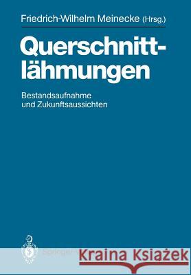 Querschnittlähmungen: Bestandsaufnahme Und Zukunftsaussichten Meinecke, Friedrich-Wilhelm 9783540518969 Springer - książka