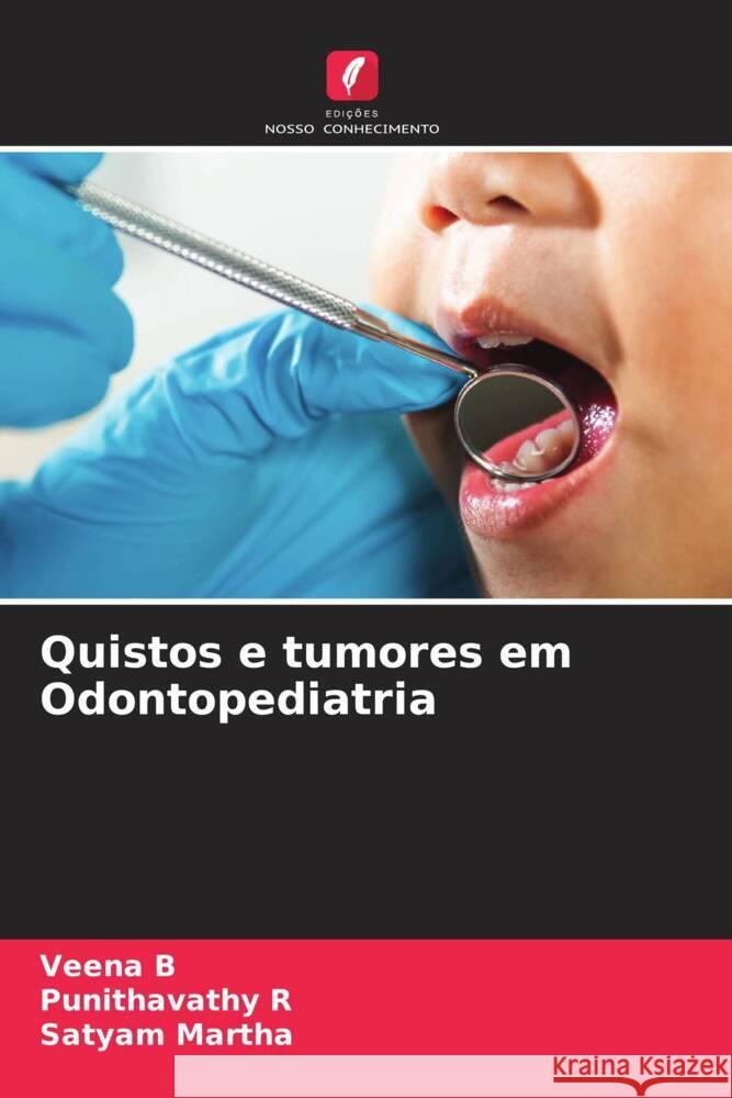 Quistos e tumores em Odontopediatria B, Veena, R, Punithavathy, MARTHA, SATYAM 9786208220310 Edições Nosso Conhecimento - książka