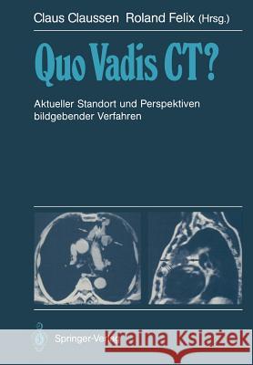 Quo Vadis Ct?: Aktueller Standort Und Perspektiven Bildgebender Verfahren Claussen, Claus 9783642732621 Springer - książka