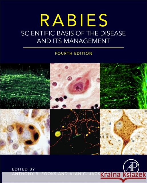 Rabies: Scientific Basis of the Disease and Its Management Anthony R. Fooks Alan C. Jackson 9780128187050 Academic Press - książka