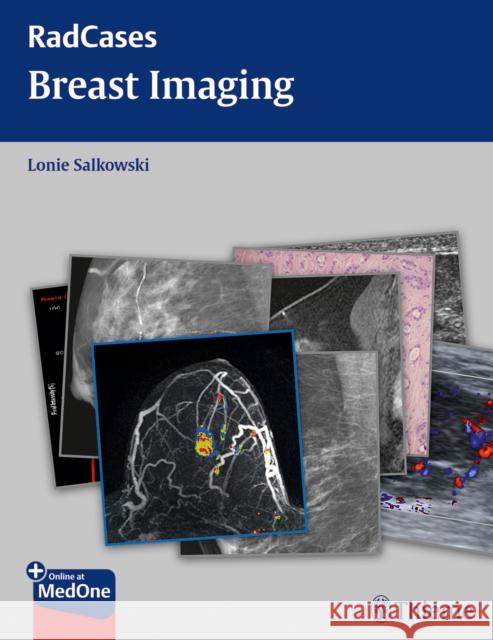 Radcases Breast Imaging Salkowski, Lonie L. 9781604061918  - książka