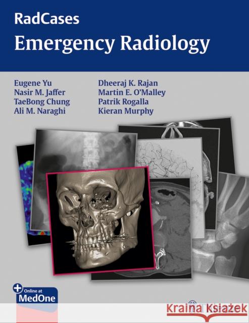 Radcases Emergency Radiology Yu, Eugene 9781604068320 Thieme Medical Publishers - książka