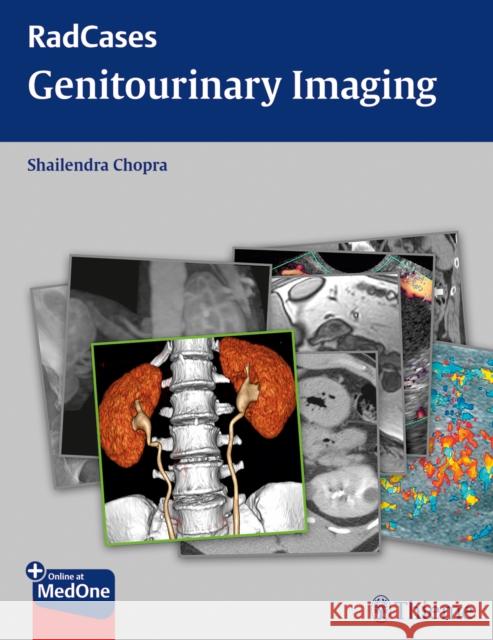 Radcases Genitourinary Imaging Shailendra Chopra 9781604063240  - książka