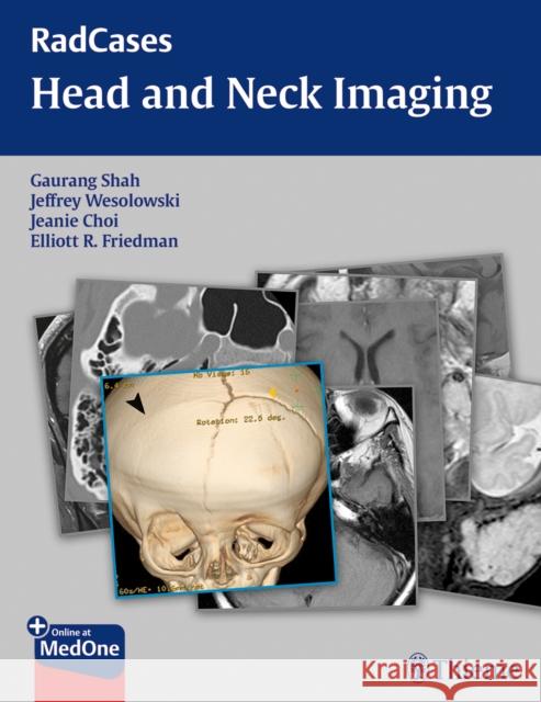 Radcases Head and Neck Imaging Shah, Gaurang 9781604061932 Thieme Medical Publishers - książka