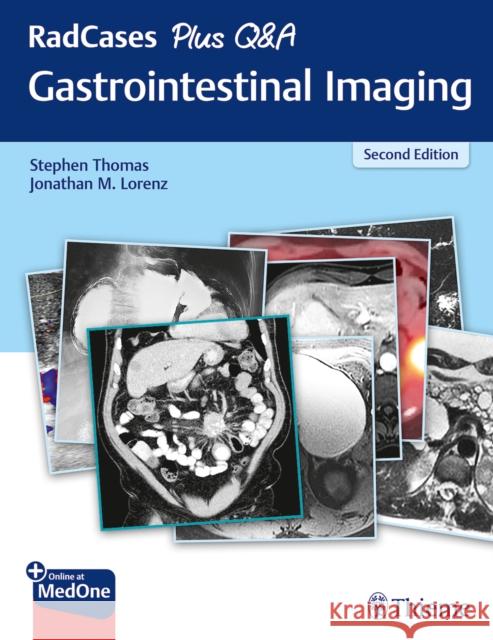 Radcases Plus Q&A Gastrointestinal Imaging Thomas, Stephen 9781626238688 Thieme Medical Publishers - książka