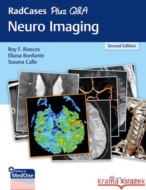 Radcases Plus Q&A Neuro Imaging Riascos-Castaneda, Roy F. 9781626232372 Thieme Medical Publishers - książka