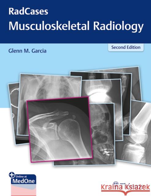 Radcases Q&A Musculoskeletal Radiology Garcia, Glenn M. 9781626232440 Thieme Medical Publishers - książka