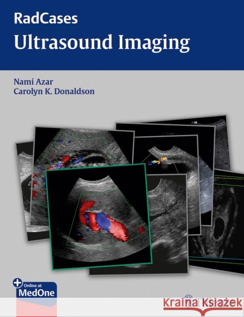 Radcases Ultrasound Imaging Dean Nakamoto Nami Azar Vikram Dogra 9781604063226 Thieme Medical Publishers - książka