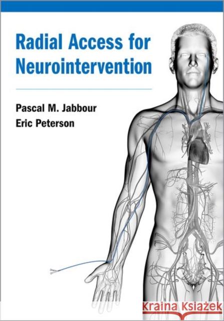 Radial Access for Neurointervention Pascal Jabbour 9780197524176 Oxford University Press, USA - książka