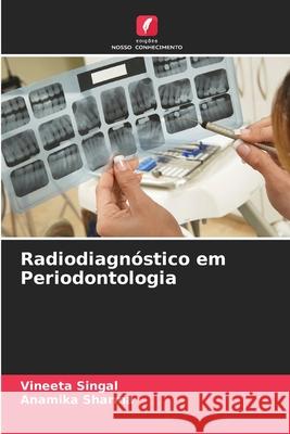 Radiodiagnóstico em Periodontologia Singal, Vineeta, Sharma, Anamika 9786206811817 Edições Nosso Conhecimento - książka