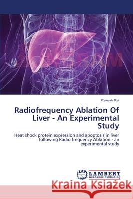 Radiofrequency Ablation Of Liver - An Experimental Study Rai, Rakesh 9783659208386 LAP Lambert Academic Publishing - książka
