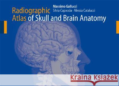 Radiographic Atlas of Skull and Brain Anatomy Massimo Gallucci Alessia Catalucci Silvia Capoccia 9783540341901 Springer - książka