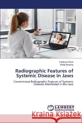 Radiographic Features of Systemic Disease in Jaws Khan, Falaknaz, Sharma, Rohit 9786206160069 LAP Lambert Academic Publishing - książka