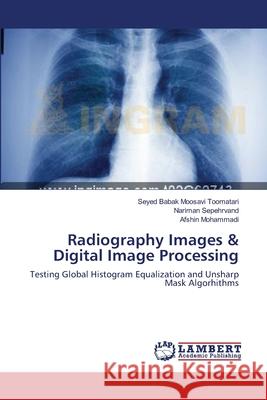 Radiography Images & Digital Image Processing Seyed Babak Moosav Nariman Sepehrvand Afshin Mohammadi 9783659178832 LAP Lambert Academic Publishing - książka