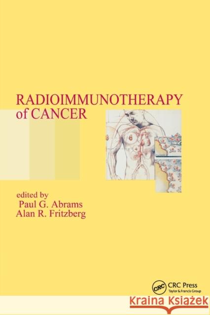 Radioimmunotherapy of Cancer Paul G. Abrams Alan R. Fritzberg 9780367398361 CRC Press - książka